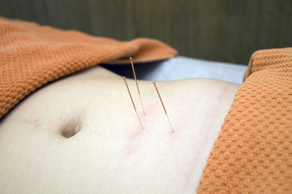 acupuncture-for-neck-pain-a-reliable-treatment-for-severe-pain-way